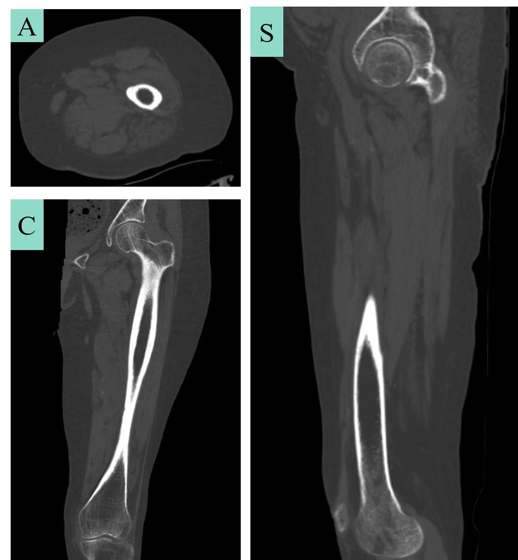 CT / micro-CT image acquisition